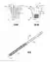 Fig. 04 - Fracture fixation system including locking cap and wire