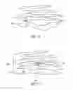 Fig. 05 - Bone plate for reducing angular bone deformity and method of using