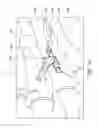 Fig. 13 - Bone plate for reducing angular bone deformity and method of using