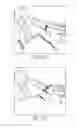 Fig. 19 - Bone plate for reducing angular bone deformity and method of using