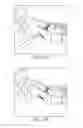 Fig. 20 - Bone plate for reducing angular bone deformity and method of using