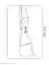Fig. 22 - Bone plate for reducing angular bone deformity and method of using