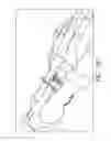 Fig. 24 - Bone plate for reducing angular bone deformity and method of using