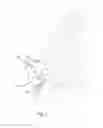 Fig. 03 - Blade anchor systems for bone fusion