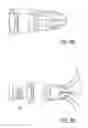 Fig. 05 - Bone implants for the treatment of infection