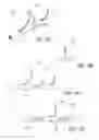 Fig. 12 - Bone implants for the treatment of infection