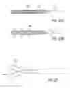 Fig. 24 - Bone implants for the treatment of infection