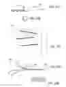 Fig. 30 - Bone implants for the treatment of infection