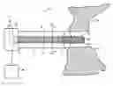 Fig. 01 - Devices and methods for treating cardiac tissue