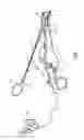 Fig. 02 - Bipolar surgical instrument