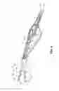 Fig. 06 - Bipolar surgical instrument with tissue stop