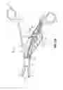 Fig. 09 - Bipolar surgical instrument with tissue stop
