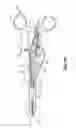 Fig. 11 - Bipolar surgical instrument with tissue stop
