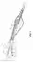 Fig. 05 - Bipolar surgical instrument