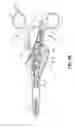 Fig. 09 - Bipolar surgical instrument