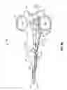 Fig. 06 - Vessel sealing instrument