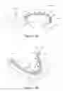 Fig. 16 - VESSEL SEALING AND CUTTING DEVICES, METHODS AND SYSTEMS