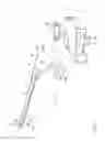 Fig. 02 - TREATMENT DEVICE AND TREATMENT SYSTEM