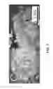 Fig. 04 - Nanoelectroablation control and vaccination