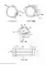 Fig. 05 - Apparatus and methods for the treatment of tissue using microwave energy