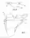 Fig. 04 - Methods for patient-specific shoulder arthroplasty