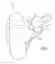Fig. 05 - Methods for patient-specific shoulder arthroplasty