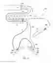 Fig. 11 - Shape sensor systems with redundant sensing