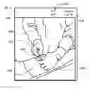 Fig. 06 - SYSTEM FOR SURGICAL INFORMATION AND FEEDBACK DISPLAY