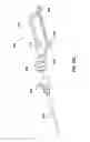 Fig. 14 - Multi-function mounting interface for an image-guided robotic system and quick release interventional toolset