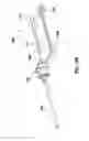 Fig. 15 - Multi-function mounting interface for an image-guided robotic system and quick release interventional toolset