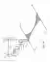 Fig. 03 - Robotic devices and systems for performing single incision procedures and natural orifice translumenal endoscopic surgical procedures, and methods of configuring robotic devices and systems