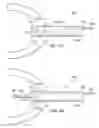 Fig. 17 - Robotic devices and systems for performing single incision procedures and natural orifice translumenal endoscopic surgical procedures, and methods of configuring robotic devices and systems
