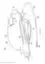 Fig. 04 - Robotic devices and systems for performing single incision procedures and natural orifice translumenal endoscopic surgical procedures, and methods of configuring robotic devices and systems