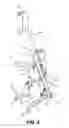 Fig. 08 - Devices for mobility assistance and infusion management