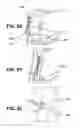 Fig. 22 - Devices for mobility assistance and infusion management