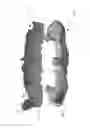Fig. 06 - Method for manufacturing surgical guide and crown, abutment in mouth for dental implant