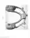 Fig. 11 - Method for manufacturing surgical guide and crown, abutment in mouth for dental implant