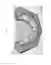 Fig. 18 - Method for manufacturing surgical guide and crown, abutment in mouth for dental implant