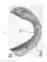 Fig. 19 - Method for manufacturing surgical guide and crown, abutment in mouth for dental implant