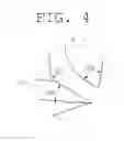 Fig. 05 - CUSTOMIZED DENTAL IMPLANT PROSTHESIS PRODUCTION METHOD USING CAD/CAM