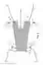 Fig. 03 - Method of treating urinary incontinence