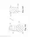Fig. 16 - Method of treating urinary incontinence