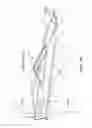 Fig. 17 - Method of treating urinary incontinence