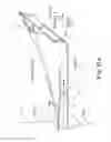 Fig. 19 - Method of treating urinary incontinence
