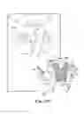 Fig. 23 - Method of treating urinary incontinence