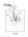 Fig. 30 - Method of treating urinary incontinence