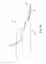 Fig. 33 - Method of treating urinary incontinence