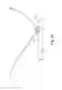 Fig. 35 - Method of treating urinary incontinence
