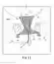 Fig. 49 - Method of treating urinary incontinence
