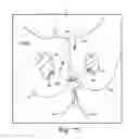 Fig. 71 - Method of treating urinary incontinence